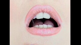 ���න්ජලා කොටි - සමලිංගික - සුදු